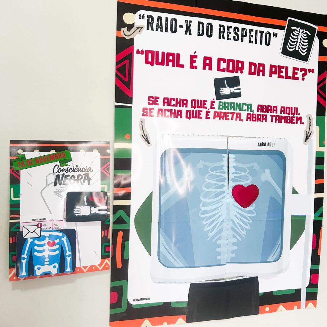 RAIO-X DO RESPEITO (20 de novembro)